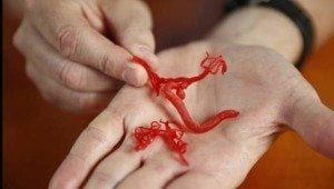 Creati vasi sanguigni con stampanti 3D