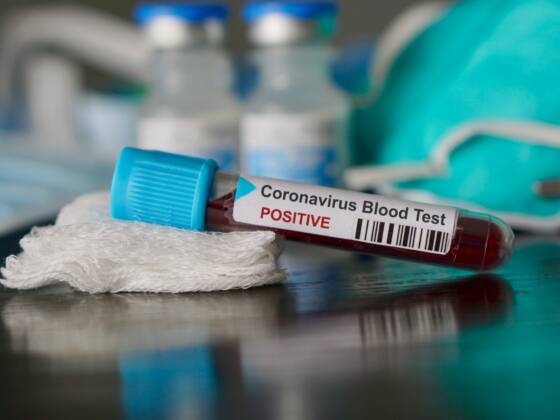 coronavirus a rischio ricaduta paziente positivo per la seconda volta 560x420 - Home Page