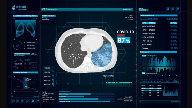 tecnologie emergenti che dimostrano valore nella lotta al coronavirus cinese cardiologia diagnostica e interventistica 800x450 - la lotta al coronavirus utilizza le TECNOLOGIE digitali EMERGENTI come la AI