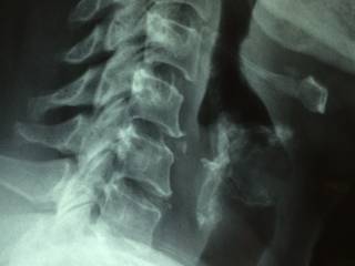 Chirurgia robotica addominale: il futuro supera la laparoscopia tradizionale