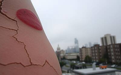 Lo smog aumenta il rischio di eczema: scopri come proteggerti!