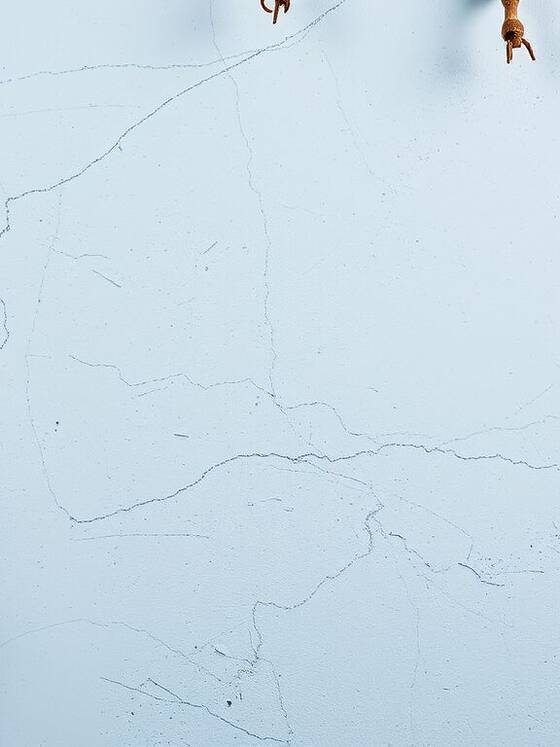 Cancro prevenibile in molti casi: strategie efficaci per ridurre il rischio