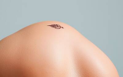 Tatuaggio scatena alopecia, vitiligine e anidrosi: il caso clinico estremo